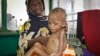 Abdulahi Musa, a malnourished five-year-old boy, sits on his mother's lap at Banadir hospital in Mogadishu, Somalia, May 20, 2014.