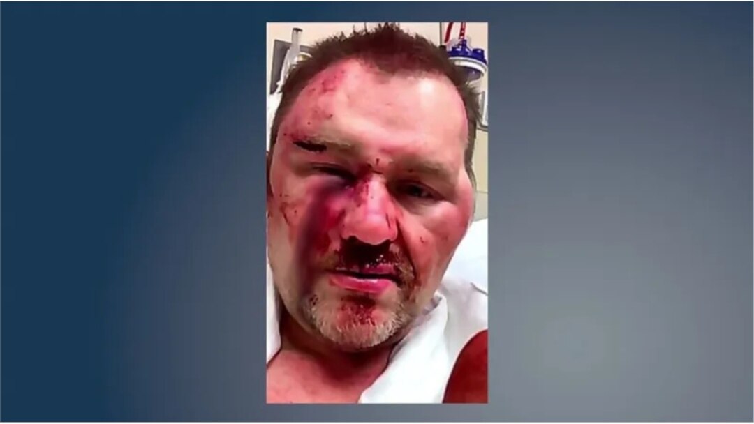 Photo provided by former Achille Mayor David Northcutt after attack at a convenience store in March 2019.