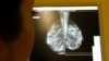 Alcohol Industry Accused of Misleading Public Over Cancer Risk