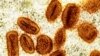 This colorized electron microscope image provided by the National Institute of Allergy and Infectious Diseases in 2024 shows Mpox virus particles, orange, found within infected cells, green. (NIAID via AP)